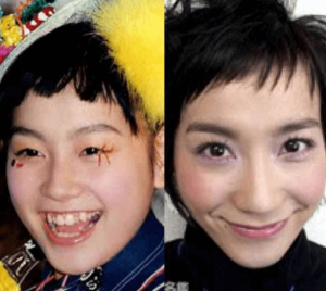 篠原ともえ　整形